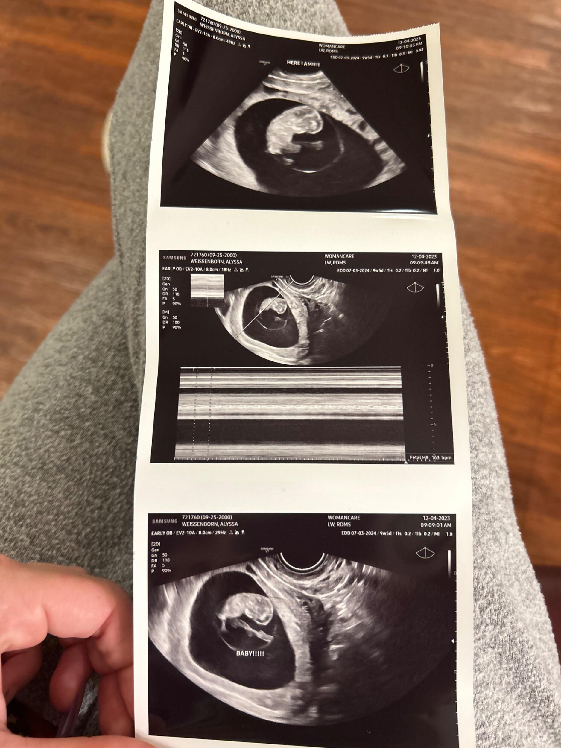 Alyssa and Derick found out their family is growing more.