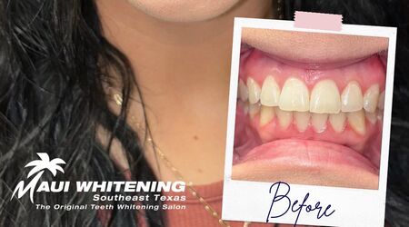 Maui Whitening SETX Beauty The Knot