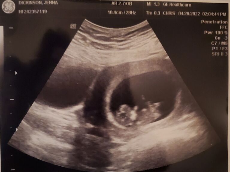 A major surprise approaches!! As you might pick out from the date, this was not taken March 12th. March 9th I had suspicions, the 12th I had a test, and April 20th (nice) was the second ultrasound. I had one around March 15th that showed a hemorrhage, after years of medical trouble I didn't even know I COULD get pregnant! They were supposed to schedule me for a hysterectomy the very January that we met, but I wanted to wait til I turned 30, so I'd moved it back and this was our ONLY shot at being biological parents... and it wasn't looking very good to start.