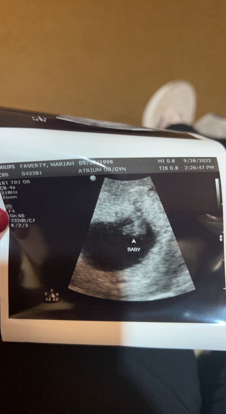 September 2022 they found out that Carter would become a big brother, He was so excited!
