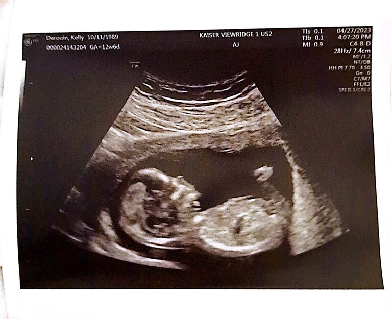 Kelly and David are surprised with the best news of all, that they will be welcoming a baby girl in the fall of 2023.... Wedding plans had to wait just a little bit longer. 