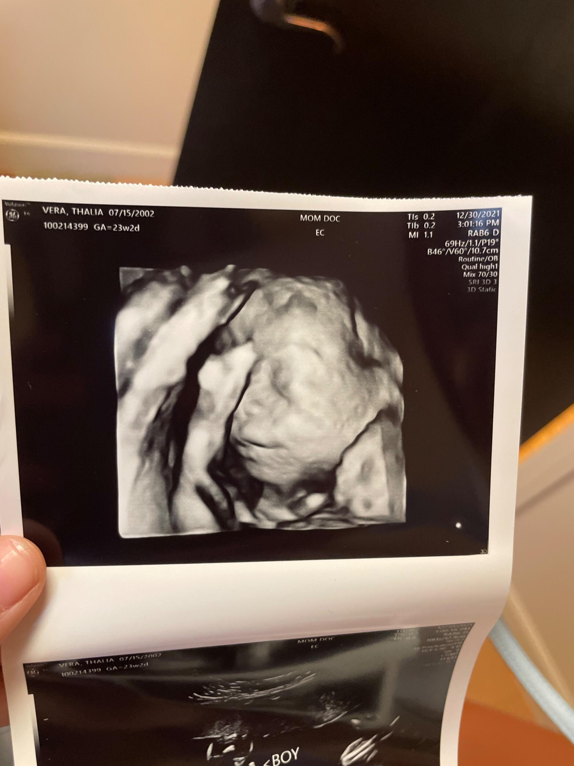 Found out we were pregnant with little Hudson!