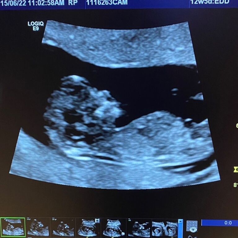 The day we found out we were expecting! We were so excited!