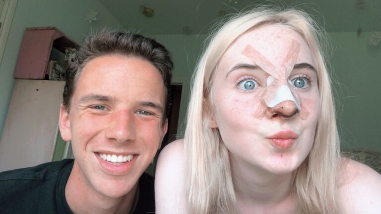 He even loved me when I had a broken nose!