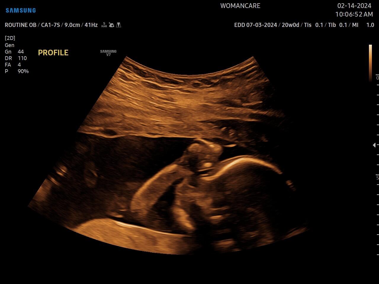 Ultrasound of the little growing baby.