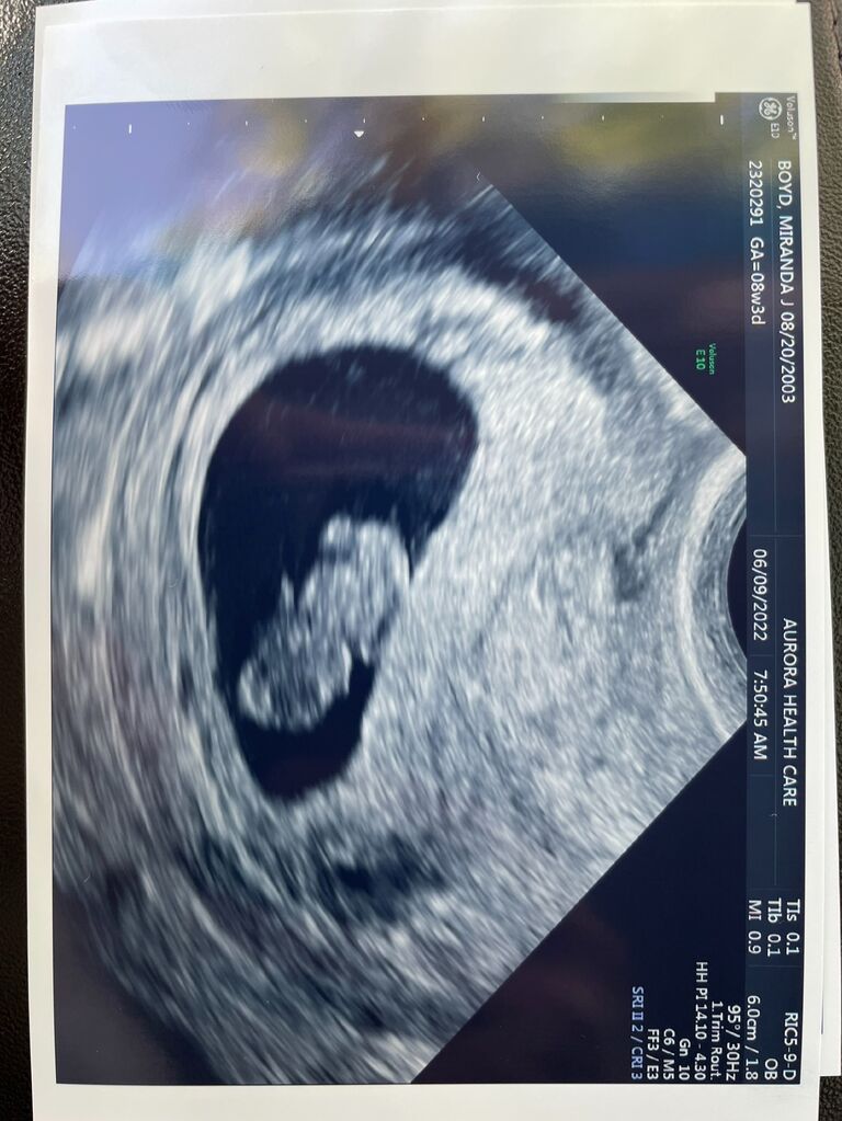 The day we found out we were pregnant