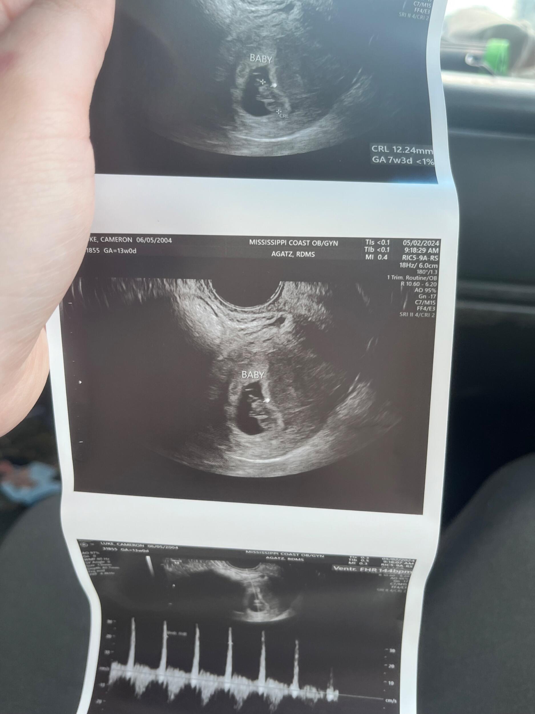 A couple weeks after we found out we were pregnant!