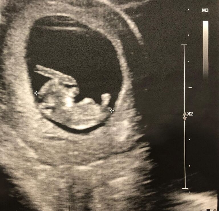 but we got distracted and made a baby <3