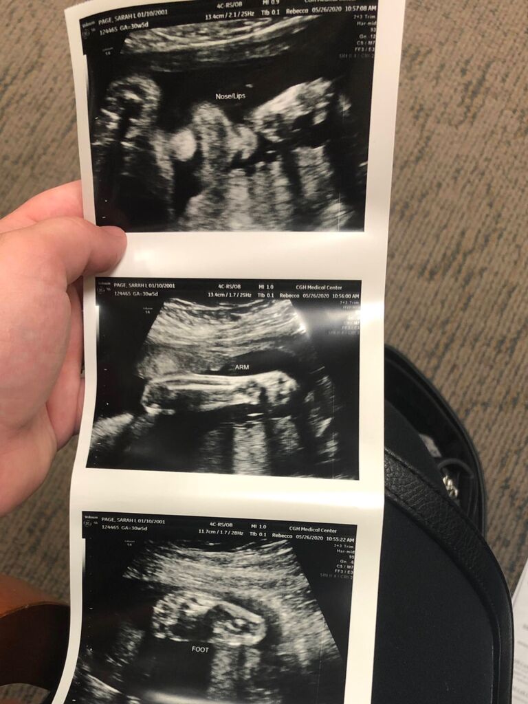 Pregnant with our first child