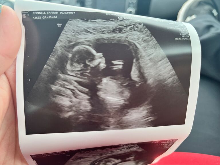 Miles Blake Wilhite