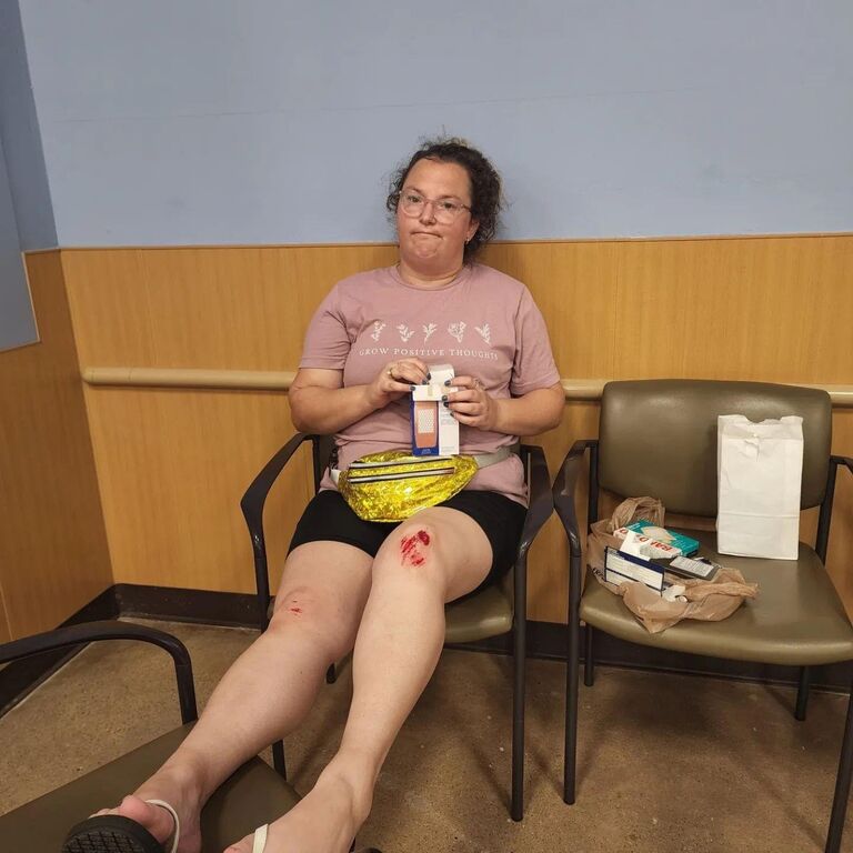 Caitlin falls, busts her knee, and Boyd nurses her back to health! 
