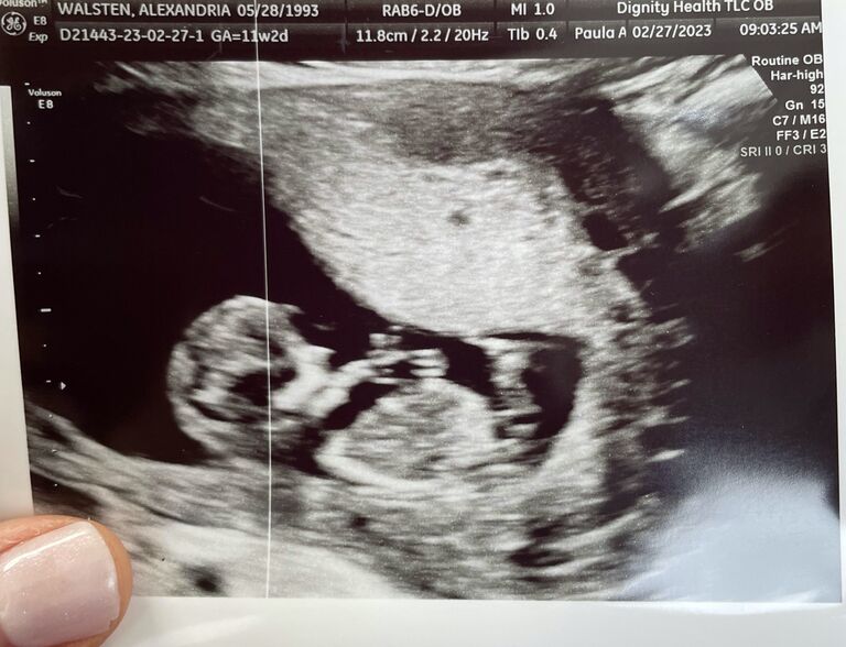 Our first glimpse of baby Ryder