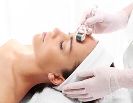 woman getting microneedling beauty treatment