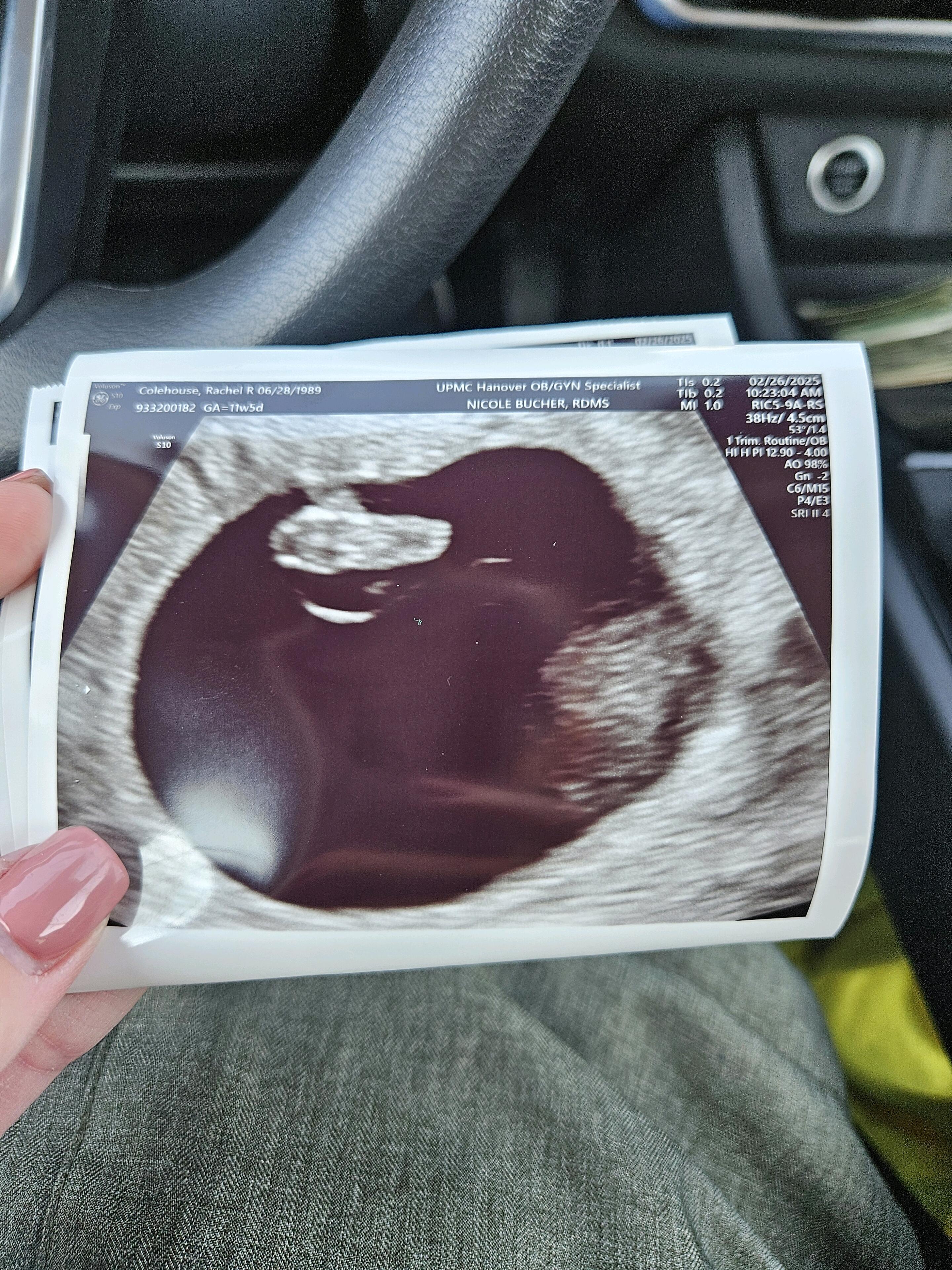 The day we saw our baby for the first time💓
