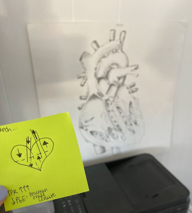 Todd won Nataleigh over with an anatomical drawing of a heart (featuring Nataleigh's version)