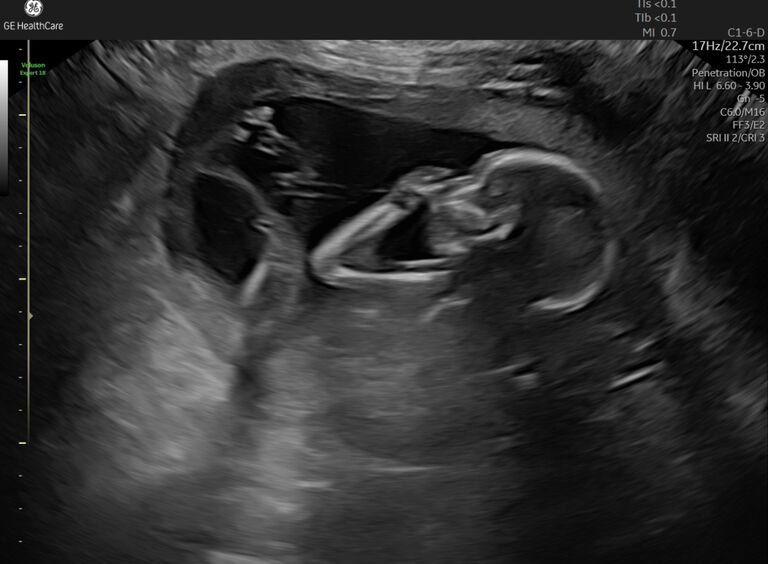 We are due with a baby boy!