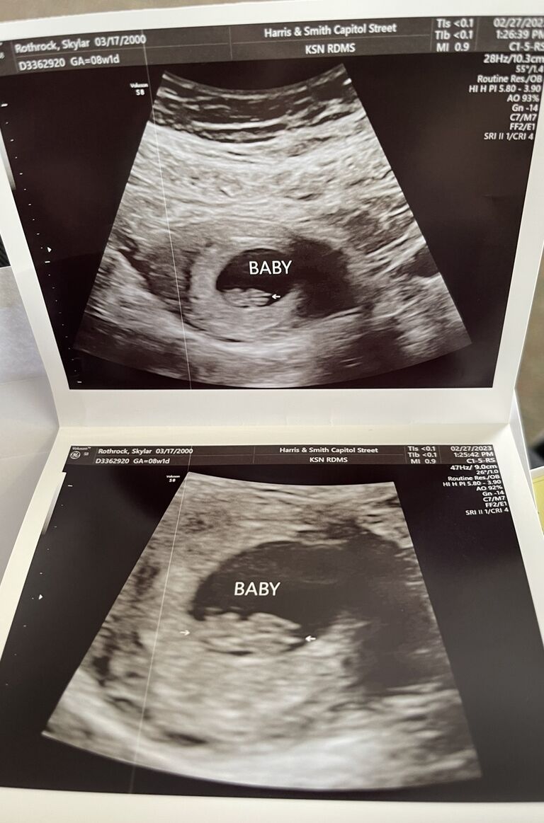 We found out we were having a baby!
