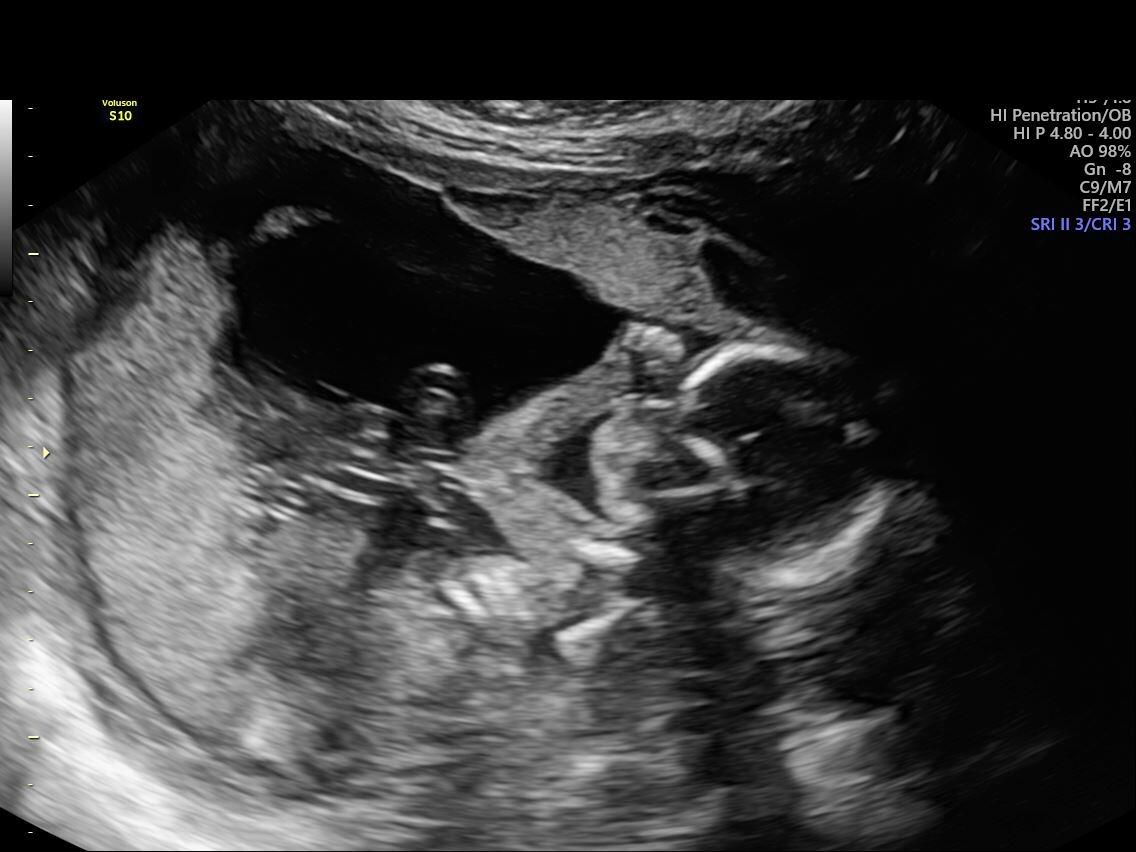 In May of 2022, we got the wonderful news that we were expecting a baby!