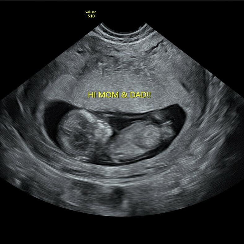 Found out we were expecting!