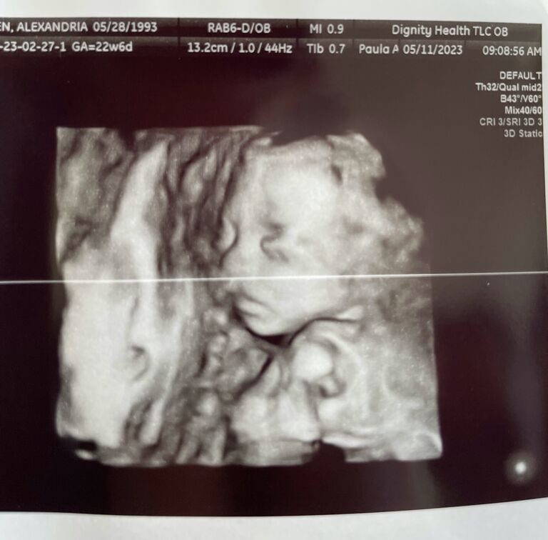 Our 2nd glimpse at baby Ryder, we love this one because it looks exactly like him in real life :)