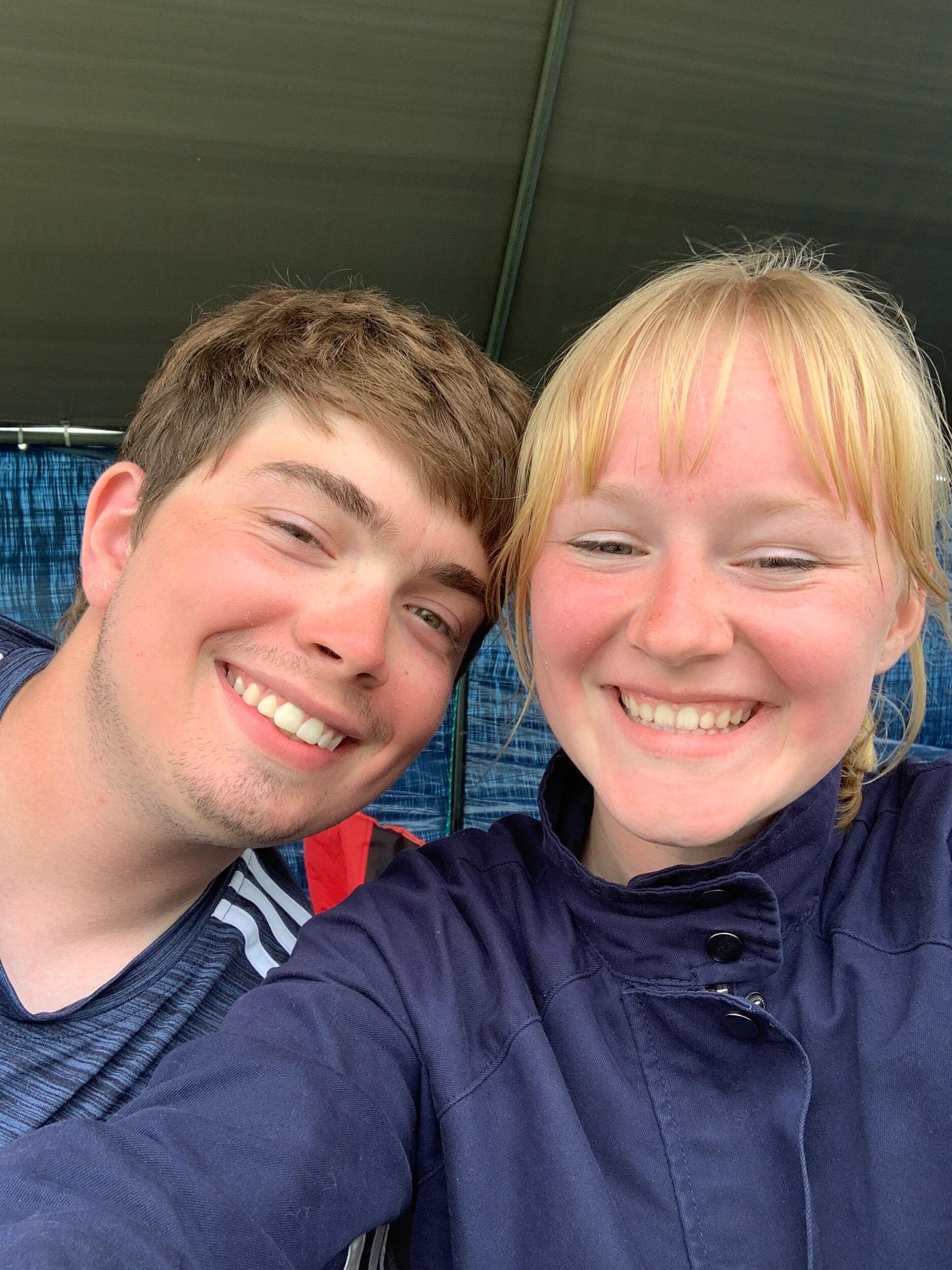 Sunburnt at AMA!