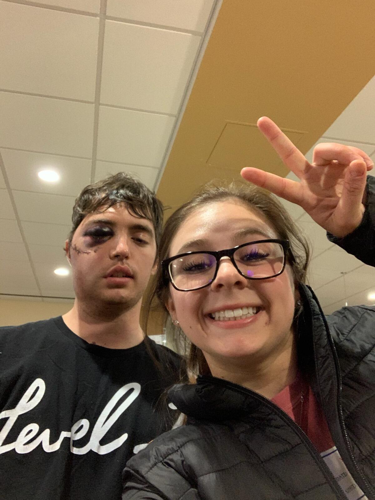 Eric Breaks His Face