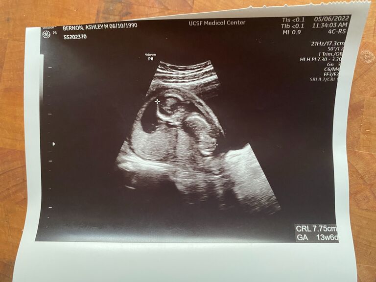 Our little bean.