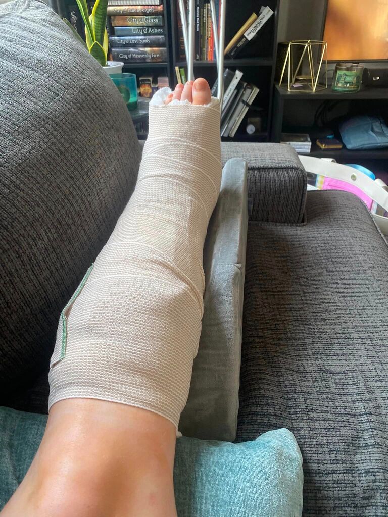Mac broke her ankle 3 days before her birthday....4 months of Sam taking care of her ensued