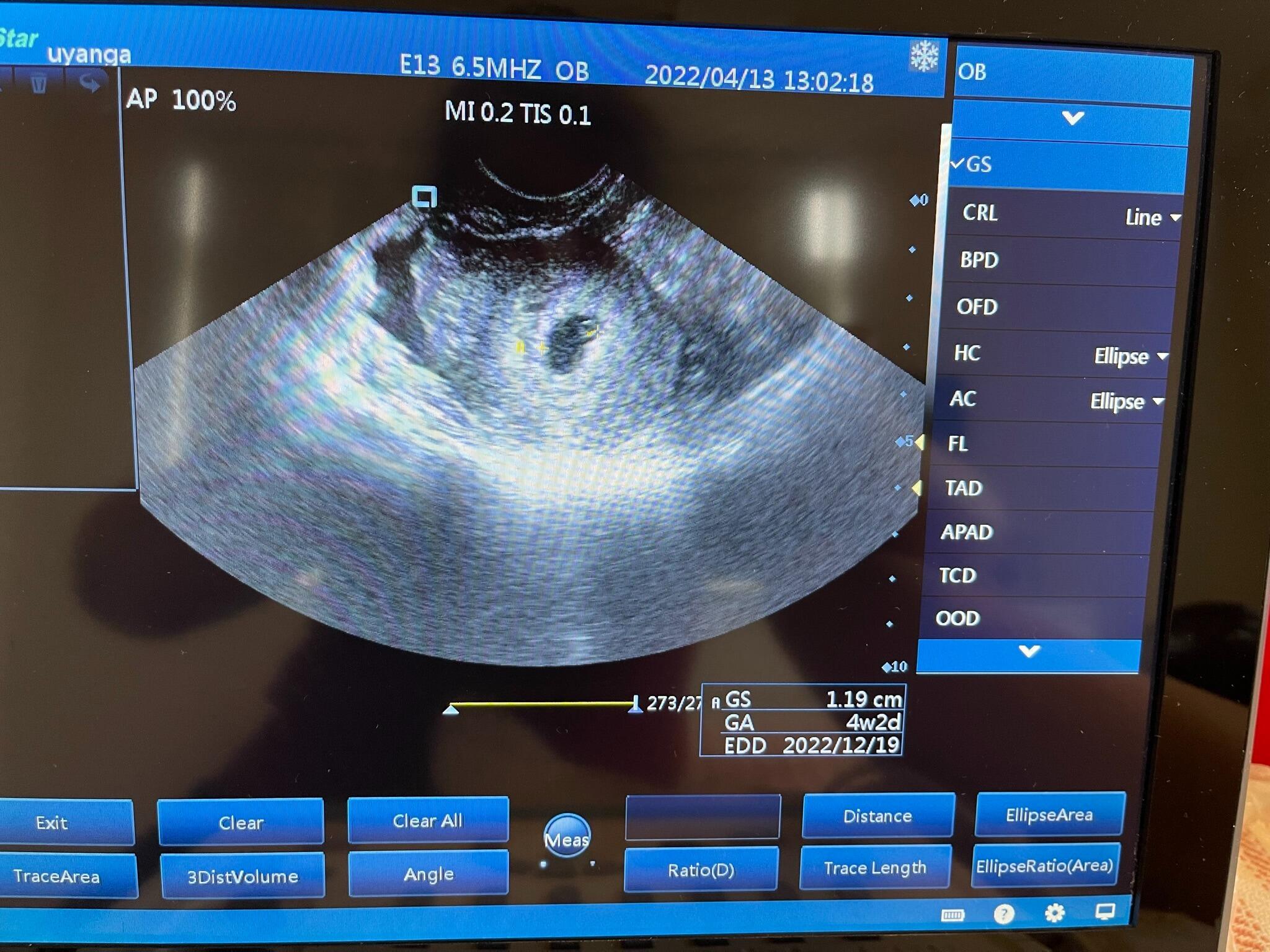 Princess Emily is right there in peanut shape ;-)